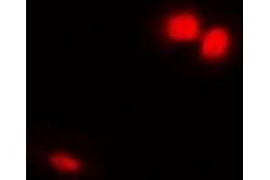 Immunofluorescent analysis of Emerin staining in Hela cells. (Emerin antibody)