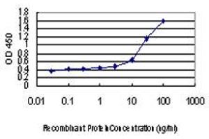Detection limit for recombinant GST tagged NR4A2 is approximately 0. (NR4A2 antibody  (AA 71-170))