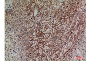 Immunohistochemistry (IHC) analysis of paraffin-embedded Human Brain, antibody was diluted at 1:100. (Neuregulin 2 antibody  (Internal Region))