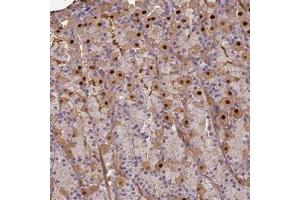 Immunohistochemical staining of human stomach with AGXT2L1 polyclonal antibody  shows distinct nuclear and cytoplasmic positivity in glandular cells. (AGXT2L1 antibody)