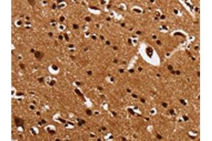 The image is immunohistochemistry of paraffin-embedded Human brain tissue using ABIN7131549(UPK3B Antibody) at dilution 1/25. (Uroplakin 3B antibody)