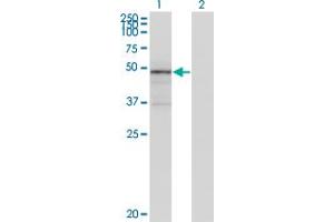 Western Blot analysis of TNXB expression in transfected 293T cell line by TNXB monoclonal antibody (M01), clone 2D3-1B10.
