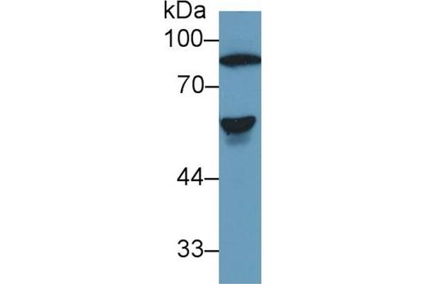 SERPINC1 anticorps  (AA 150-426)