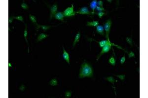 Immunofluorescence staining of U251 cells with ABIN7165837 at 1:166, counter-stained with DAPI.