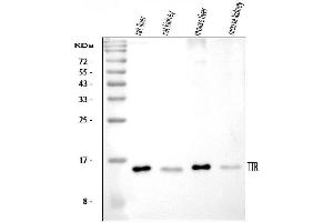 Western blot analysis of Prealbumin using anti-Prealbumin antibody (ABIN3042346). (TTR antibody  (AA 21-147))