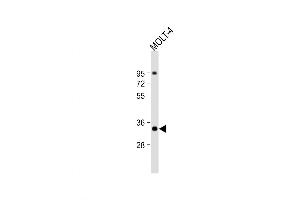 Western Blot at 1:1000 dilution + MOLT-4 whole cell lysate Lysates/proteins at 20 ug per lane. (ZWINT antibody  (AA 59-88))