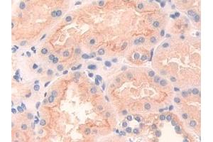 Detection of DEP1 in Human Kidney Tissue using Polyclonal Antibody to Density Enhanced Phosphatase 1 (DEP1)