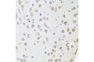 Immunohistochemistry of paraffin-embedded mouse brain using TARS antibody (ABIN5974207) at dilution of 1/100 (40x lens). (TARS antibody)