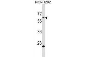 Western Blotting (WB) image for anti-Amyloid beta (A4) Precursor Protein-Binding, Family A, Member 3 (APBA3) antibody (ABIN3000609) (APBA3 antibody)