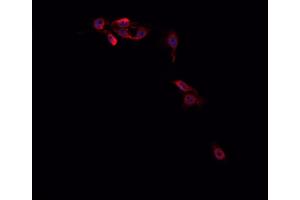 ABIN6266714 staining Hep G2 cells by IF/ICC. (MED14 antibody  (Internal Region))