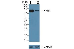 Knockout Varification: ;Lane 1: Wild-type BXPC-3 cell lysate; ;Lane 2: VNN1 knockout BXPC-3 cell lysate; ;Predicted MW: 57kDa ;Observed MW: 57kDa;Primary Ab: 3µg/ml Rabbit Anti-Human VNN1 Antibody;Second Ab: 0.
