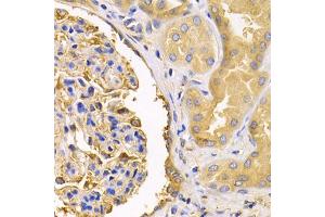 Immunohistochemistry of paraffin-embedded human kidney using USO1 antibody (ABIN1875291) at dilution of 1:200 (40x lens). (USO1 antibody)