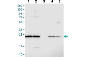 Western blot analysis of Lane 1: RT-4, Lane 2: U-251 MG, Lane 3: Human Plasma, Lane 4: Liver, Lane 5: Tonsil with C14orf166 polyclonal antibody  at 1:250-1:500 dilution.