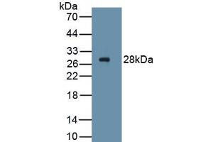 Detection of Recombinant PDGFRa, Human using Monoclonal Antibody to Platelet Derived Growth Factor Receptor Alpha (PDGFRa) (PDGFRA antibody  (AA 170-387))