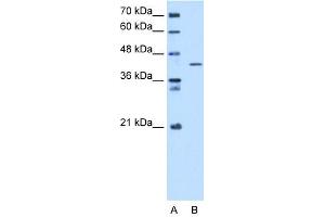 WB Suggested Anti-SEPHS1 Antibody Titration:  5. (SEPHS1 antibody  (C-Term))