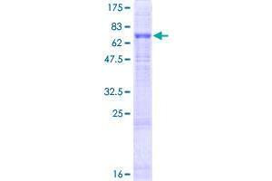 FBXO15 Protein (AA 1-434) (GST tag)