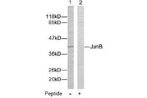 Image no. 2 for anti-Jun B Proto-Oncogene (JUNB) (Ser259) antibody (ABIN197141) (JunB antibody  (Ser259))