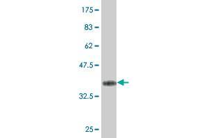 Western Blot detection against Immunogen (37.