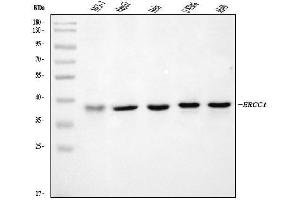 Western blot analysis of ERCC1 using anti-ERCC1 antibody (ABIN7602324).