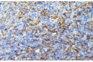 Immunohistochemistry of paraffin-embedded Mouse spleen using COX15 Polyclonal Antibody at dilution of 1:100 (40x lens).