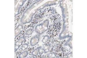 Immunohistochemical staining of human duodenum with MANEA polyclonal antibody  shows distinct cytoplasmic positivity in a sub-set of inflammatory cells at 1:10-1:20 dilution.