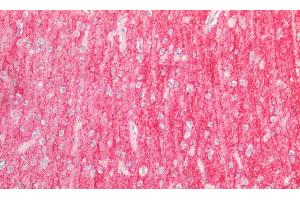 Detection of ICAM5 in Human Cortex Tissue using Polyclonal Antibody to Intercellular Adhesion Molecule 5 (ICAM5) (ICAM5 antibody  (AA 409-674))