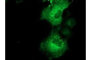 Anti-QPRT mouse monoclonal antibody (ABIN2453564) immunofluorescent staining of COS7 cells transiently transfected by pCMV6-ENTRY QPRT (RC202960). (QPRT antibody)