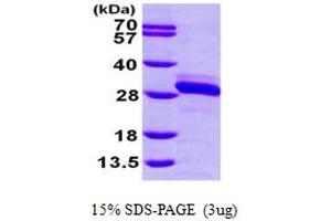 SDS-PAGE (SDS) image for Ras-related Protein Ral-A (rala) (AA 1-203) protein (His tag) (ABIN667292)
