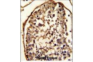 Paraformaldehyde-fixed, paraffin embedded human testis tissue, Antigen retrieval by boiling in sodium citrate buffer (pH6. (TUBB antibody)