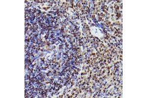 Immunohistochemistry of paraffin-embedded mouse spleen using MEF2A+MEF2C Rabbit mAb (ABIN1679049, ABIN1679050, ABIN7101495 and ABIN7101496) at dilution of 1:100 (40x lens). (MEF2A+MEF2C antibody)