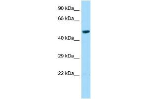 Host: Rabbit Target Name: L2HGDH Sample Type: HepG2 Whole Cell lysates Antibody Dilution: 1. (L2HGDH antibody  (Middle Region))