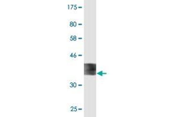 Ferredoxin1 (FDX1) (AA 85-183) antibody