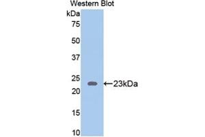 Western blot analysis of the recombinant protein. (Thrombospondin 1 antibody  (AA 71-259))