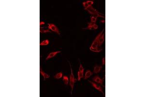 ABIN6276023 staining LOVO by IF/ICC. (GPR180 antibody  (Internal Region))