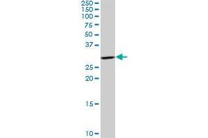 HSD17B12 polyclonal antibody (A01), Lot # 060803QCS1. (HSD17B12 antibody  (AA 203-271))