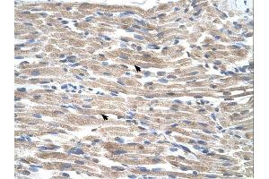 Immunohistochemistry (IHC) image for anti-BMP2 Inducible Kinase (BMP2K) (C-Term) antibody (ABIN2775440) (BMP2K antibody  (C-Term))
