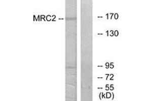 Western blot analysis of extracts from 293 cells, using MRC2 Antibody. (MRC2 antibody  (AA 121-170))