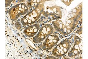 Phospho-TAO2 (Ser181) Antibody at 1/100 staining Rat colorectal tissue by IHC-P.