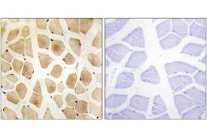 Immunohistochemistry analysis of paraffin-embedded human skeletal muscle tissue, using SLK Antibody. (SLK antibody  (AA 1151-1200))