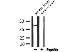Western blot analysis of extracts from mouse brain, using STAC3 Antibody. (STAC3 antibody  (Internal Region))