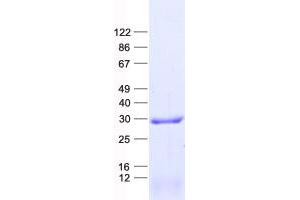 Validation with Western Blot (GBAS Protein (His tag))