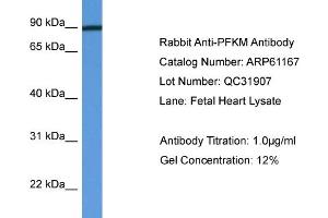 Western Blotting (WB) image for anti-phosphofructokinase, Muscle (PFKM) (C-Term) antibody (ABIN2788704) (PFKM antibody  (C-Term))