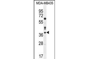 CASP3 Antibody (C-term) (ABIN655271 and ABIN2844863) western blot analysis in MDA-M cell line lysates (35 μg/lane). (Caspase 3 antibody  (C-Term))