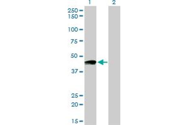 Prostacyclin Receptor antibody  (AA 296-386)