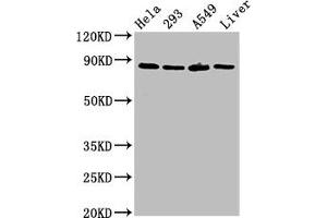 Western Blot Positive WB detected in: Hela whole cell lysate, 293 whole cell lysate, A549 whole cell lysate, Rat liver tissue All lanes: USP10 antibody at 3 μg/mL Secondary Goat polyclonal to rabbit IgG at 1/50000 dilution Predicted band size: 88, 93 kDa Observed band size: 88 kDa (USP1 antibody  (AA 453-592))