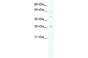 WB Suggested Anti-SPI1 Antibody Titration: 0. (SPI1 antibody  (Middle Region))