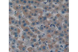 Immunohistochemistry (IHC) image for anti-serpin Peptidase Inhibitor, Clade B (Ovalbumin), Member 4 (SERPINB4) (AA 38-215) antibody (ABIN5014346)