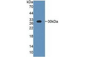 Detection of Recombinant CSN1, Bovine using Polyclonal Antibody to Casein Alpha (CSN1) (Casein alpha S1 antibody  (AA 16-187))