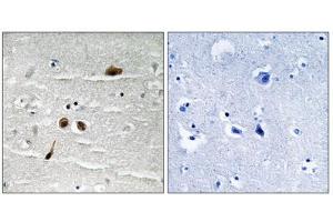 Immunohistochemistry analysis of paraffin-embedded human brain tissue using MDC1 (Phospho-Ser513) antibody. (MDC1 antibody  (pSer513))