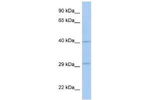 ART5 antibody used at 1 ug/ml to detect target protein.